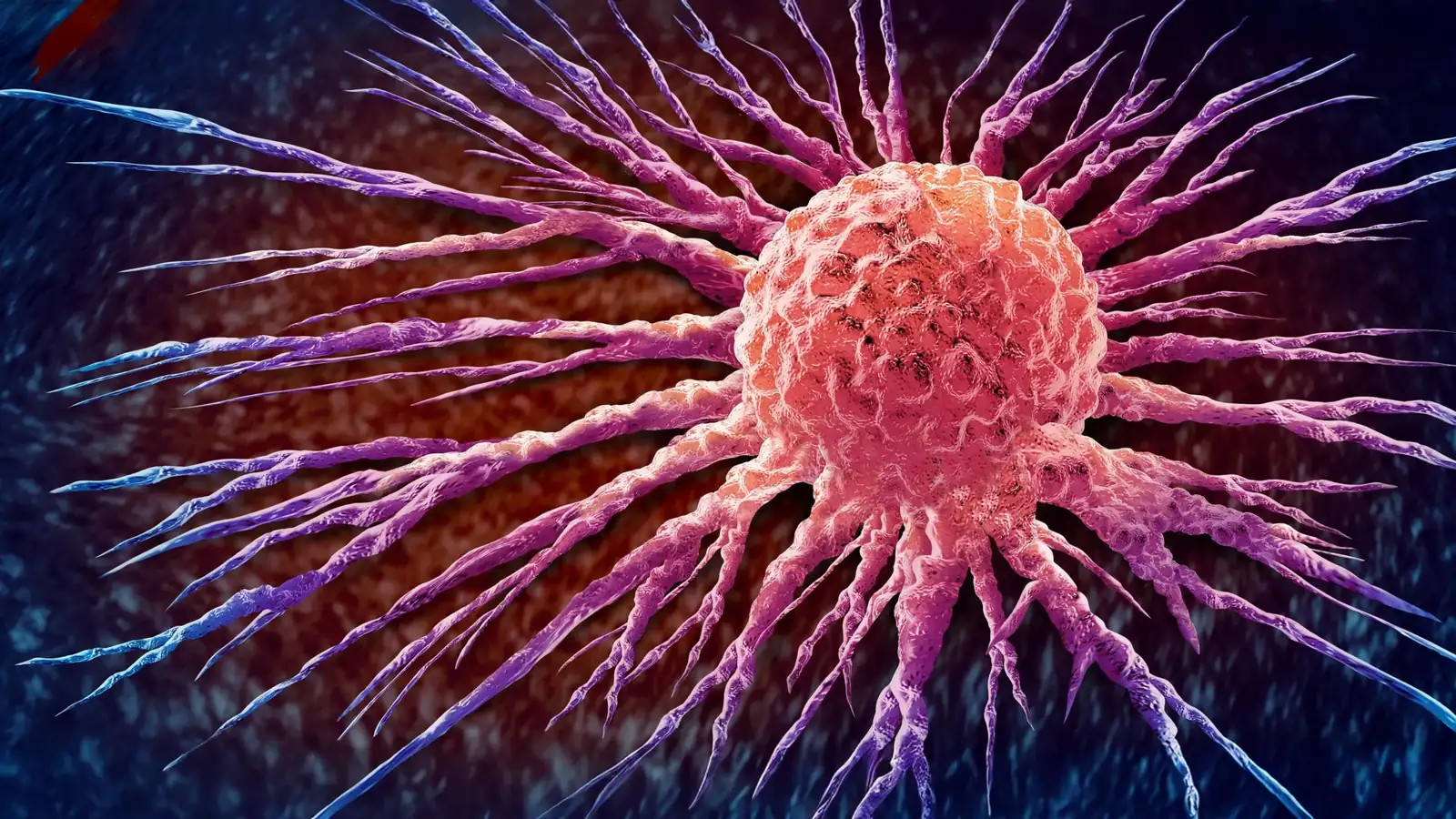 Global Cancer Cases Double: World Unprepared for 2050 Surge